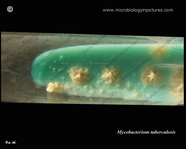 colonies of MT on Lowenstein-Jensen medium